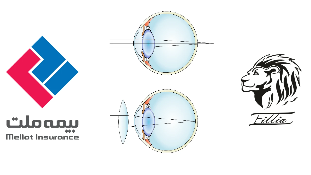 چشم پزشکی طرف قرارداد بیمه ملت
