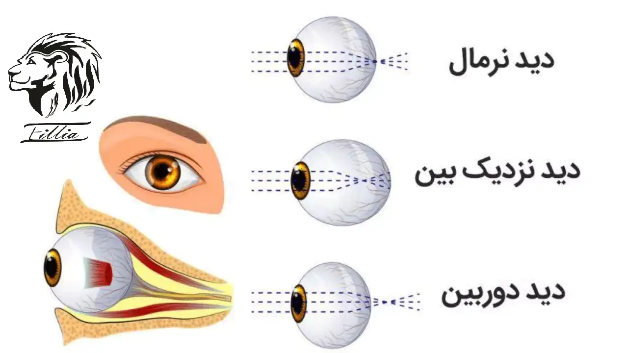 چشم ها