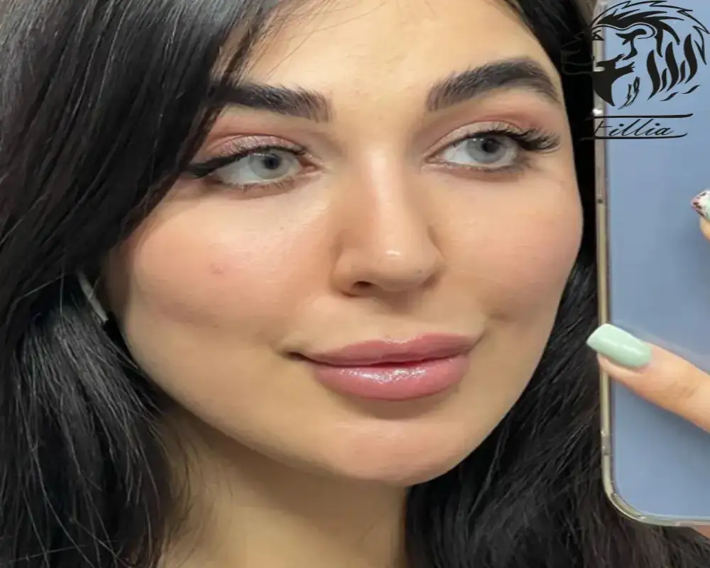 لنز چشم آرین مراحل خرید و توضیحات تکمیلی 7 لنز چشم آرین لنز چشم طبی