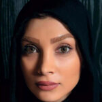 لنز چشم آرین