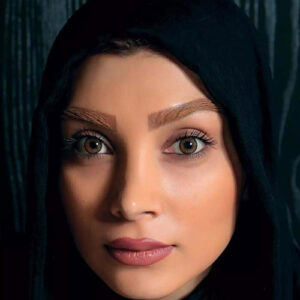 لنز چشم آرین
