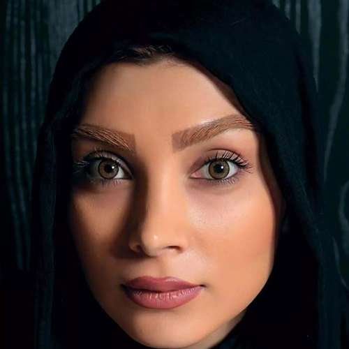 لنز-رنگی-آرین-براون-تن-2 لنز چشم آرین