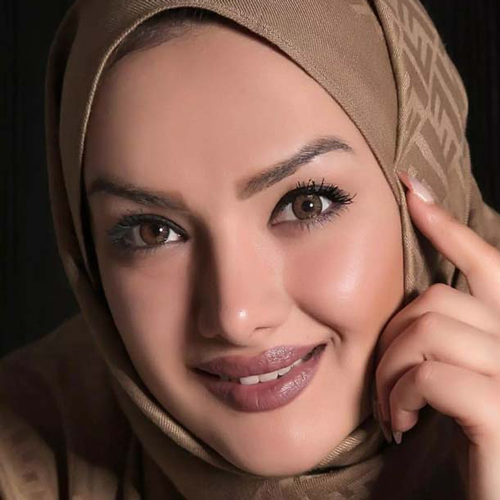 لنز-رنگی-آرین-براون-تن-3