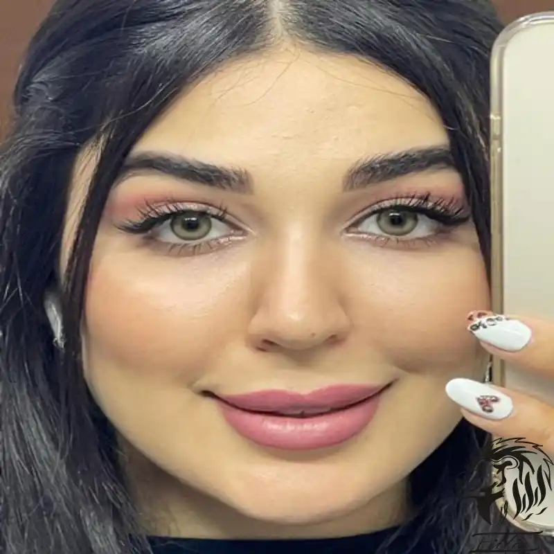 لنز چشم طبی رنگی 